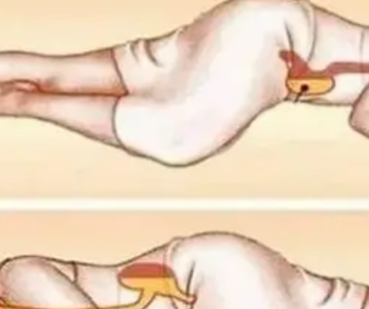 The amazing benefits of sleeping on your left side